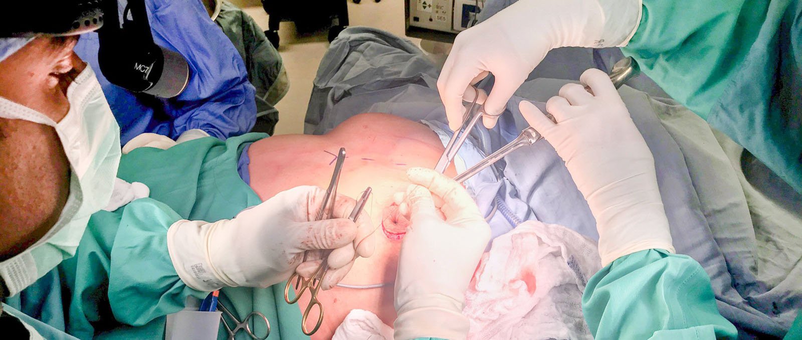 2021-11-18-breast-surgery-hero