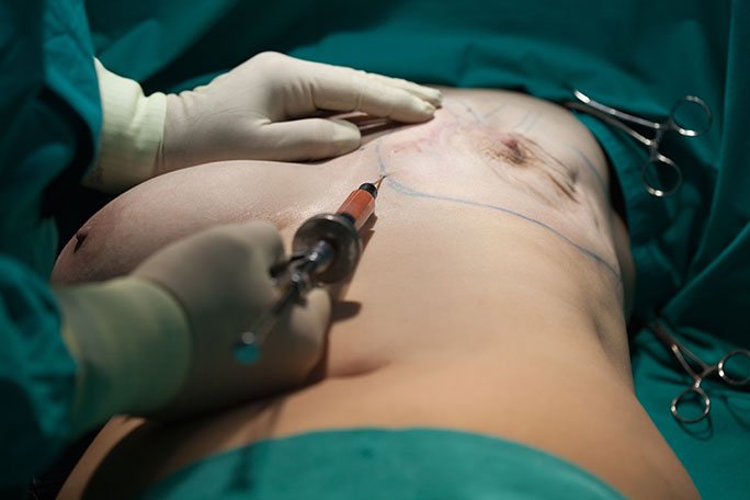 682e0fe98a932461232378 (1)