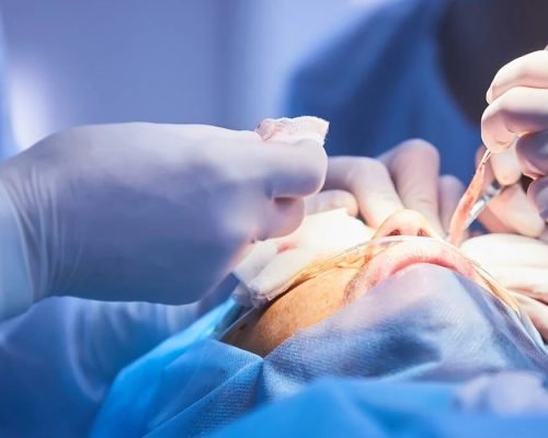 cirugia-reconstructiva-facial-portada