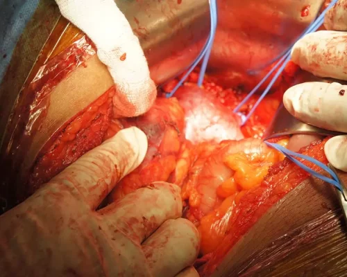curso-avances-en-el-diagnóstico-tratamiento-y-seguimiento-del-carcinoma-renal-suprarrenal-y-retroperitoneo.jpg