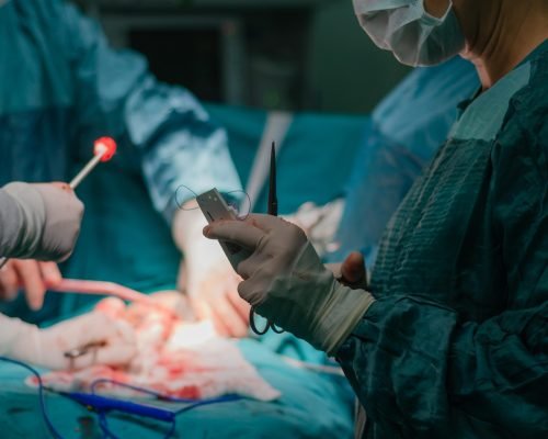 Hysterectomy surgery.General view during surgery, blurred background.The nurse prepares the thread for stitching during surgery.