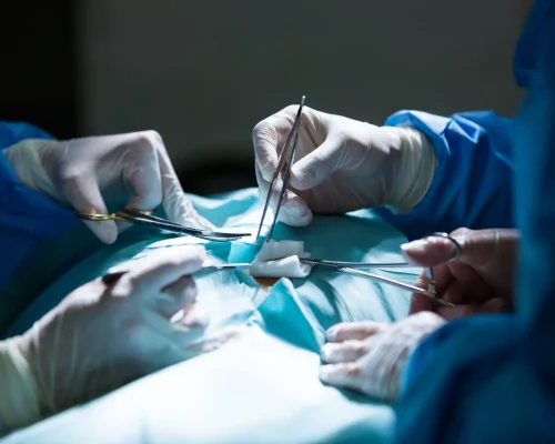 Surgeons performing operation in operation room at the hospital
